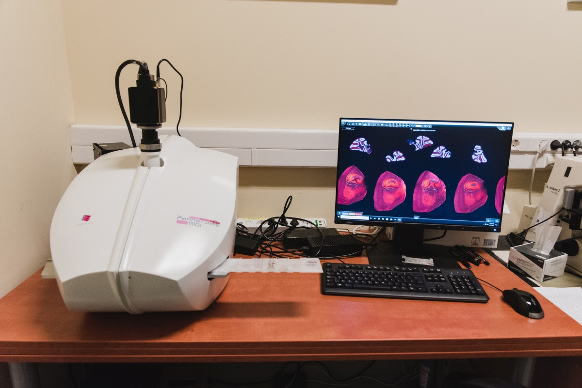Az agyról készült sorozatmetszeteket fényképezi le automatikusan