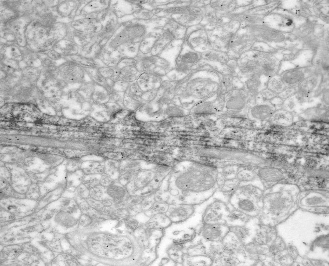 Jelőlt idegsejt dendrit rajta elhelyezkedő, aranyszemcsékkel azonosított gátló bemenetekkel