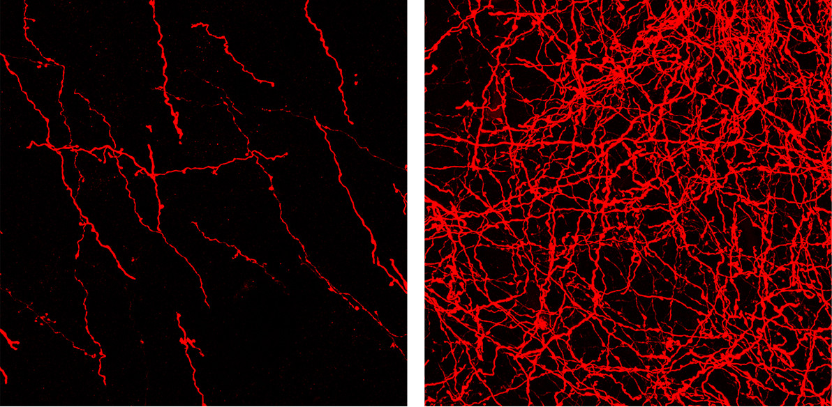 Fluorescently labelled axons in the tegmentum (left) and in the striatum (right). The density of these axons are visibly different in the two regions.