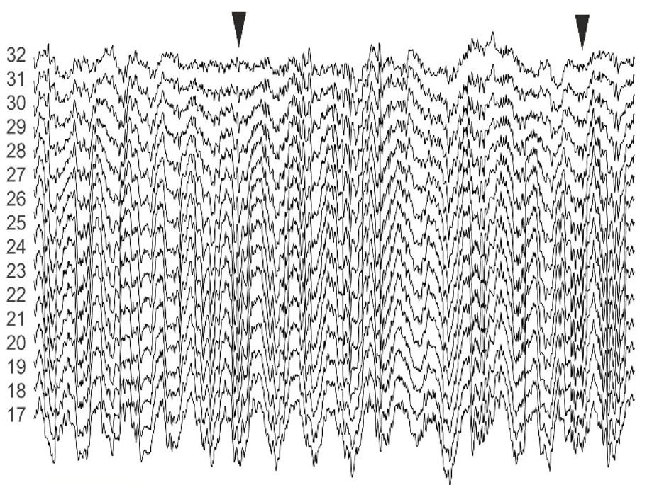 Hippocampal theta oscillation in anesthetized rat. Electrophysiology recording by Balazs Hangya, visualized by Barnabas Kocsis. Hippocampal theta oscillation in anesthetized rat. Electrophysiology recording by Balazs Hangya, visualized by Barnabas Kocsis.