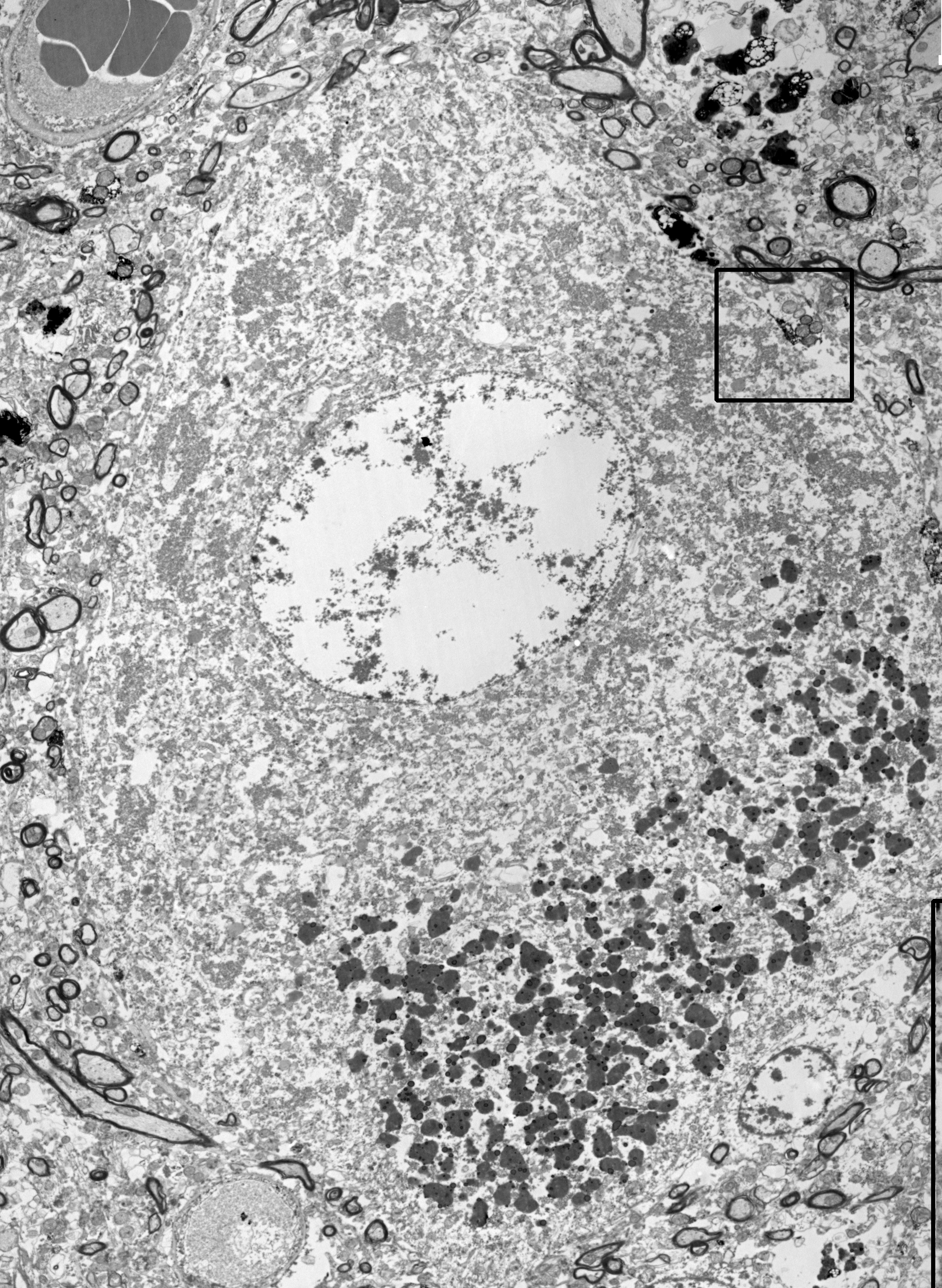 Betz sejt parvalbuminnal (PV) immunjelölt elektronmikroszkópos képe