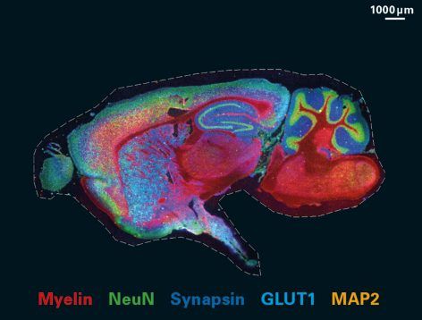 Egéragy metszete, melyen eltérő színekkel festették a rostok lefutását jelző myelint (piros), az idegsejtek sejtmagját (zöld), a szinapszisokat (sötétkék), az idegsejtek dendritjeit (sárga), valamint a gliasejteket és agyi kapillárisokat (világoskék).