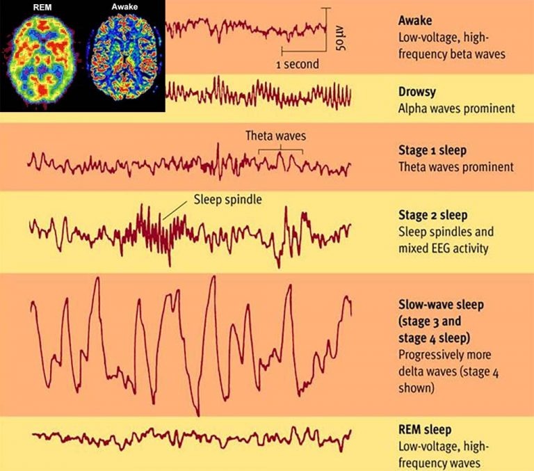 Az alvás egyes fázisaihoz társuló EEG hullámok. Elálmosodás, elalvás és alvás alatt az EEG aktivitás lassul.
