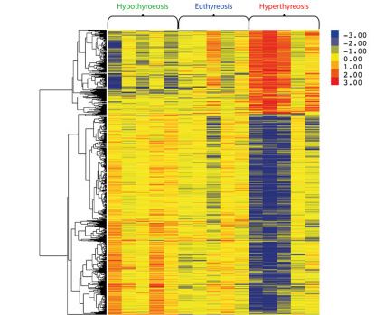 A génkifejeződés szintjének megváltozása egészséges (középső kék feliratú kapcsos zárójeles oszlopok), illetve pajzsmirigy alul (zöld felirat, bal oldalt) és túlműködés esetén (piros, jobb oldalt). A színskála a jobboldalon mutatja milyen erősen nőtt meg (piros) vagy csökkent le (kék) egy gén kifejeződése.