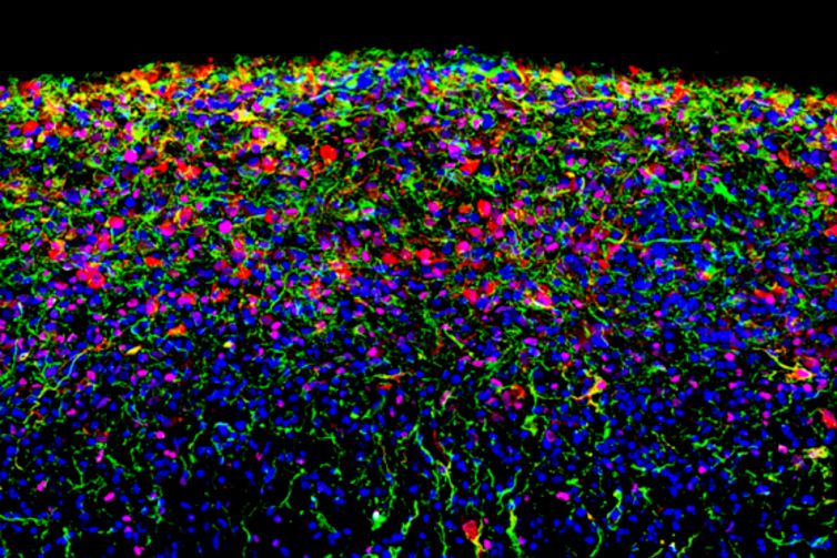 Egy emberi indukált pluripotens őssejtvonalból származtatott agyorganoid, amelyet 180 napig tenyésztettek in vitro, magas fokú sejttípus-diverzitást mutat, többek között radiális gliasejteket (magenta) és asztrocitákat (zöld és vörös). A sejtmagok kék színnel vannak jelölve.