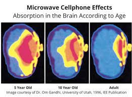 Milyen mértékben nyeli el az 5, 10 éves gyerek és a felnőtt agya mobiltelefonból származó mikrohullámot.