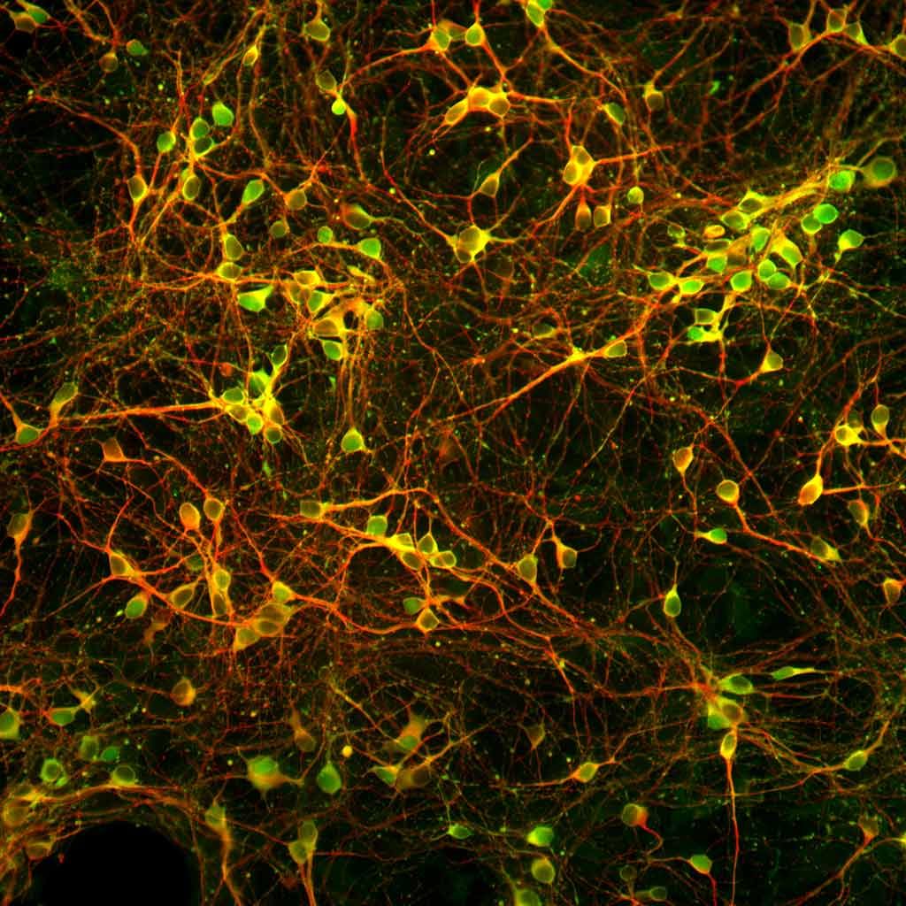 Idegsejtek és gliasejtek klasszikus tenyészete. A sejtek  kapcsolatrendszere véletlen, mivel nem irányították fejlődési lépcsők és kölcsönhatások.