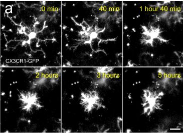 Microgliasejt alakjának változás a sérülést követő 5 órában. A kezdetben kiterült sejt nyúlványrendszere összehúzódik és zámtalan apró, az egyszövetet letapogató nyúlványt növeszt.