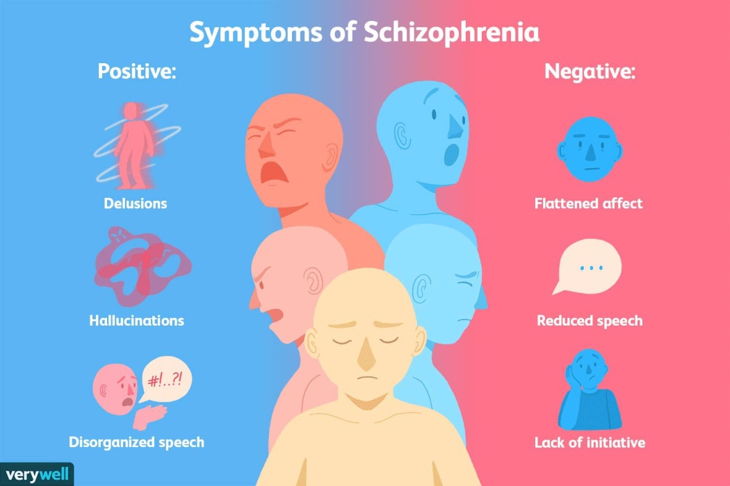 A skizofréniát pozitív és negatív tünetek kísérik