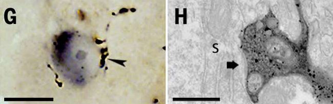 A baloldali fénymikroszkópos felvételen egy feketével jelölt parvalbumin tartalmú gátlósejtet beidegző jelölt axonterminálisok láthatók. Jobboldalon a nyíllal jelölt axonterminális látható, melyben a nyomkövetésre használt jelölőanyag fekete csapadékot képzett. A nyíl a két elem között megfigyelhető gátló szinapszisra mutat.