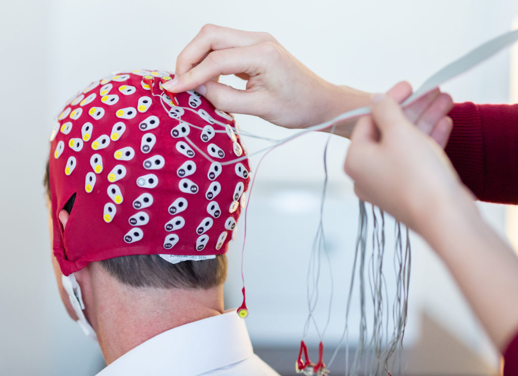 Sokcsatornás EEG sapka