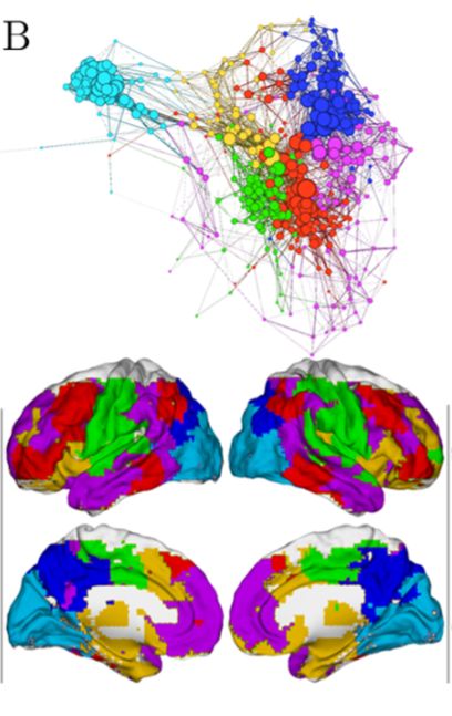 fMRI-vel megfigyelt kölcsönhatás hálózatok (fent) az agy eltérő működésű területei között.