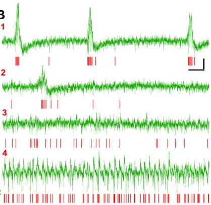 Az agyszelet állapotváltását bemutató ábra. Egy 20 perces kísérlet eltérő fázisaiból mutatunk be 2 másodperces szakaszokat. A zöld vonal mutatja a mezőpotenciált (helyi EEG), azaz  ahálózat működését, a piros vonalak pedig, hogy egy serkentő sejt mikor tüzel minezek alatt. Az 1-es időpontban látszik, hogy a sejtek nem szólalnak meg az SWR-ek között, de alattuk erősen. A carbachol szeltre mosásával az SWR-ek eltűnnek, de az átlag sejtaktivitás elkezd megnőni (2-3). A kialakult gamma oszcilláció alatt (4) a sejtek gyakran aktívak, de egy-egy gamma ciklus rövid és az aktivitás nem nő olyan magasra, mint az SWR-ek csúcsán.. 