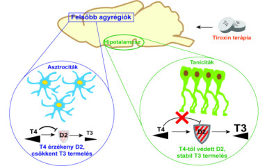 Untangling the "brain fog", or a breakthrough in understanding the brain's thyroid hormone homeostasis