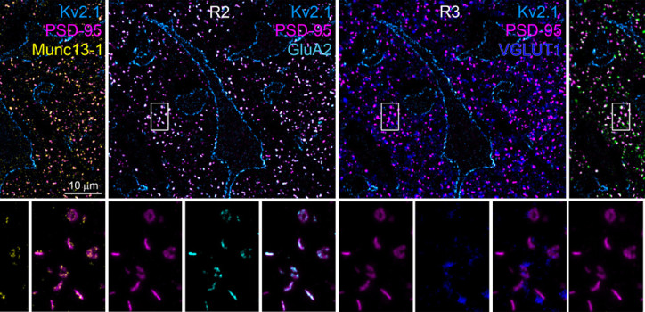 A small step closer to understanding schizophrenia diakép