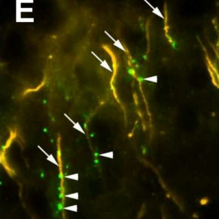 A gátlósejt axonterminálisok (zöld) más idegsejtek axon eredésén (sárga) alkotnak kapcsolatokat