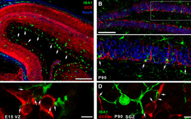 Mikromanipuláció: szomatikus mikroglia-neuron kapcsolatok a fejlődő agyban