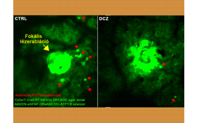 Everything you want to know and see about microglia...