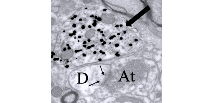 Ezüstözött kolloidális arany szemcsékkel jelölt GnRH dendrit ultrastrukturális képe diakép