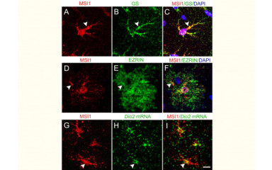 PMH, astrocytic cells and a new cell division mechanism