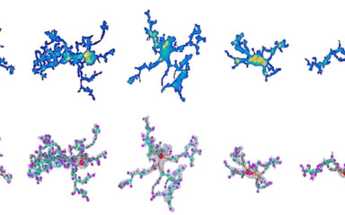 And again the microglial cells