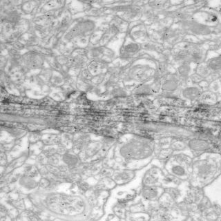 Jelőlt idegsejt dendrit rajta elhelyezkedő, aranyszemcsékkel azonosított gátló bemenetekkel