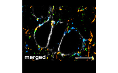 A periszomatikus gátlás neuronhálózati szerveződése a medialis prefrontális kéregben