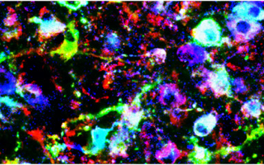 Immunofluorescent multiple-labeling, confocal microscopy