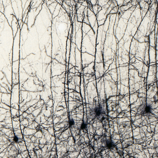 Ezeknek az idegsejteknek a nyúlványai (axonjai) az egész agyban végigkövethetők.