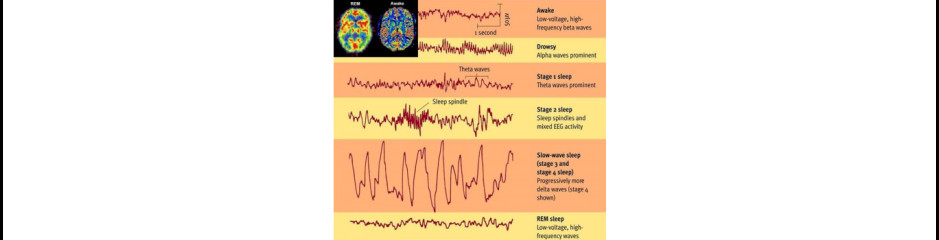 Az EEG és a viselkedés összefüggése I.