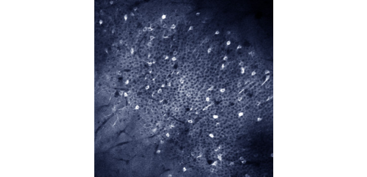 In vivo két-foton képalkotás diakép