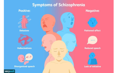 Agyi kommunikációs zavarok II: Miben különbözik a skizofrének agya a nem skizofrénekétől?