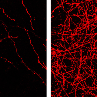Fluorescently labelled axons in the tegmentum (left) and in the striatum (right). The density of these axons are visibly different in the two regions.