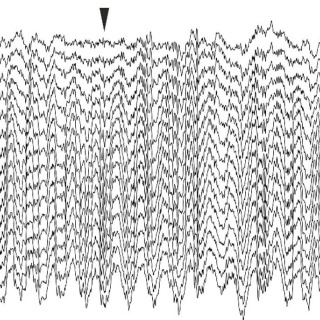 Hippocampal theta oscillation in anesthetized rat. Electrophysiology recording by Balazs Hangya, visualized by Barnabas Kocsis.