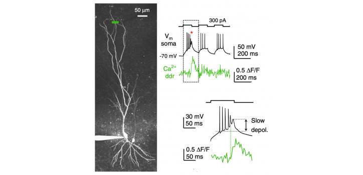 Patch-clamp electrophysiology combined with in vitro two-photon imaging diakép