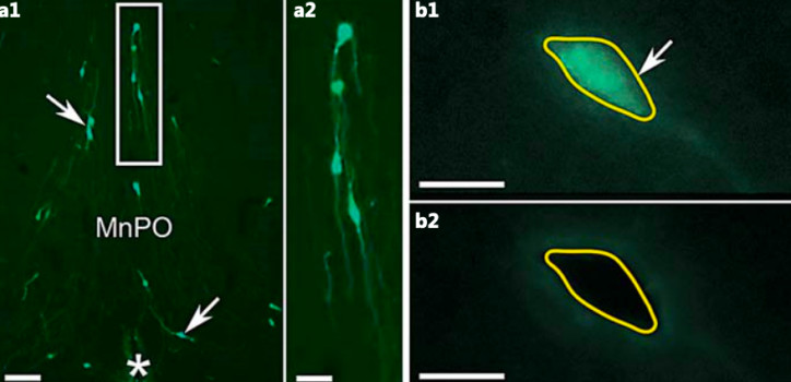 Laser capture microdissection of GnRH neurons for transcriptome analysis diakép