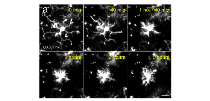 Our study on microglia in acute slices on BioRxiv diakép