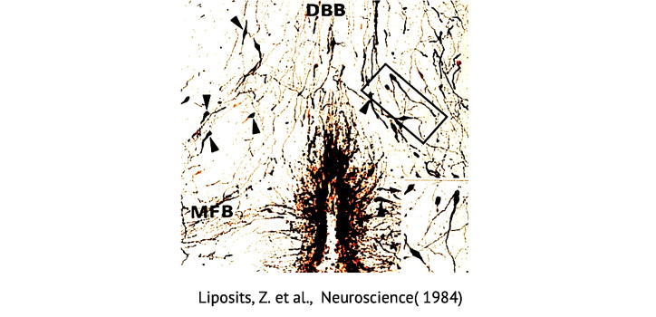 GnRH neurons labeled with silver-gold-intensified diaminobenzidine chromogen diakép