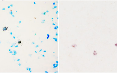 In situ hybridization with radioisotopic and digoxigenin-labeled cRNA probes