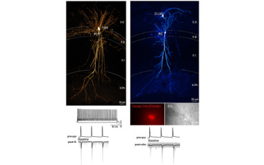 Revealing the molecular, structural and functional heterogeneity of cortical synapses