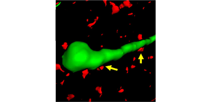 GnRH neuront beidegző kolinerg axonok diakép
