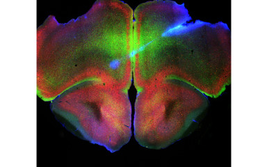 Regulation of arousal level by midline thalamic and prefrontal cortical connections