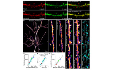 Quantitative immunohistochemistry